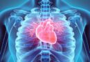 Ar seco pode causar até infarto; veja como se proteger